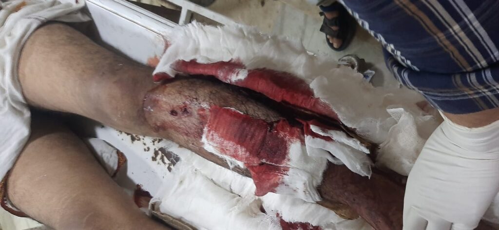 नागौर का भावण्डा हत्याकांड : आज भी कोई सुलह नहीं हो पाई, शव के साथ पुलिस थाने का घेराव 3 भावण्डा