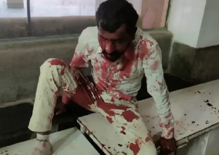 lunkarsar bikaner accident