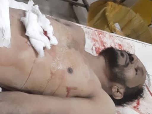 पुलिस कस्टडी में आरोपी को दिन दहाड़े गोलियों से भून डाला
